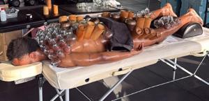 Dünyaca ünlü isim hacamat yaptırdı