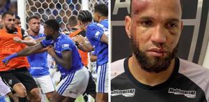 Tarihin en büyük futbol kavgasının raporu ortaya çıktı