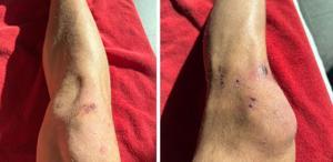 Dün gece yaşanan tarihi zaferin bedeli