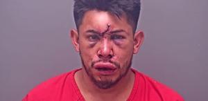 13 yaşındaki çocuk, evdeki olayı görünce babasını bu hale getirdi