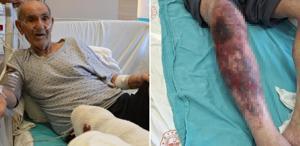 Herkesin başına gelebilir Tıkalı lavaboyu açmak isterken yandı