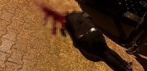 Sokakta yürürken tabanca ile başından vuruldu