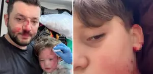 Yalova’da husumet büyüyor: Aynı ailenin 8 yaşındaki çocuğu da yaralandı