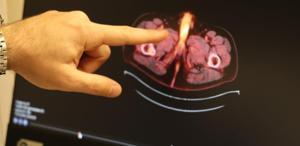 Tıp literatürüne giren son isim Diyarbakır’dan Penisi alındı