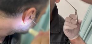 Kulağına gizlediği uyuşturucuyla yakalandı