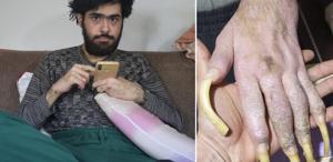 Türkiye’nin konuştuğu Barış’ın son hali 25 yaşını kutladı, türkü bile söyledi