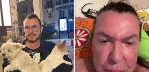 Yüzünü gerdiren Kuşum Aydın’ın son hali ortaya çıktı