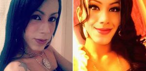 Güzellik uğruna yüzü tanınmaz hale geldi Yine akıllanmadı