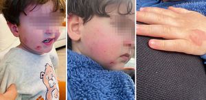 Kreşe bıraktığı çocuğunu darp edilmiş halde aldı