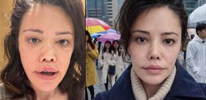 “Kore’de yüz nakli oldum” demişti… Didem Ceran: Bebeksiliğim yapay zeka değil