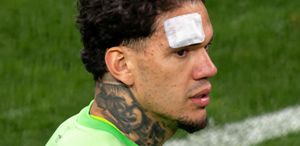 Ederson’a yabancı madde atan şahıs tespit edilerek savcılığa sevk edildi