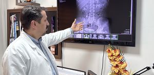 İdrar kanalından çıkan 51 taş, doktorları bile şaşkına çevirdi