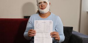 Prenses cilt bakımı yüzünü yaktı: Oğlum “öcü“ deyip benden kaçıyor