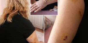 Dini nikahlı eşi 30 yerinden bıçakladı: Yarım kalan işini tamamlayacak