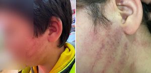 Bu kadarına da pes Veliler okulda 8 yaşındaki çocukları dövdü