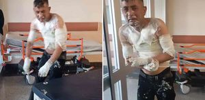 Engelli vatandaşı benzin döküp yakan vicdansıza verilen ceza belli oldu