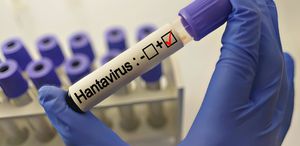 Hantavirüs grip gibi başlıyor Bu belirtiler varsa aman dikkat