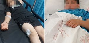 Çocukların elleri tetikte 9 yaşında parkta vuruldu