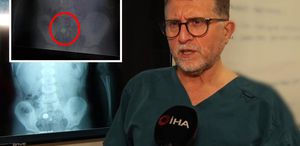 Şeker sanıp yuttu, pil olduğu filmde ortaya çıktı: Ölüme kadar götürebiliyor