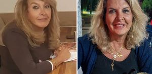 İranlı kadının kimliği implant ve platinden tespit edildi