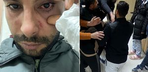 Hastasına yumruk atan doktora dava