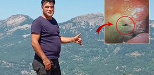Kabus gibi olay Midesinden canlı böcek çıkarıldı
