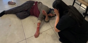 Saldırgan köpek kadının kolunu kopardı