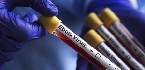 Kongo’da ebola salgını: 1155 vaka, 304 ölüm
