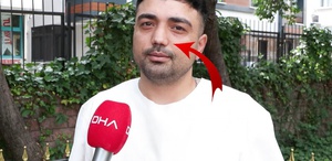 Burun ameliyatına girdi, başına gelmeyen kalmadı İşini bile kaybetti