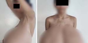13 yaşında başladı Göğüsleri vücut ağırlığının dörtte birine ulaştı