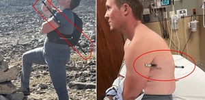 Mucize kurtuluş Bu halde 16 kilometre yürüdü