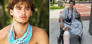 Survivor’da bacağını kaybeden yarışmacıdan yeni paylaşım: Yeni hayatına alışmaya çalışıyor
