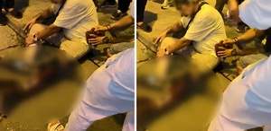 Pitbull kavgası kanlı bitti: Köpek sahibi bıçaklandı
