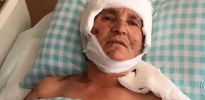 Yaşlı kadın evinin önünde dehşeti yaşadı: Yargıtay’dan köpek saldırısında emsal karar
