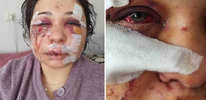 Polis memuru kocasının öldüresiye dövdüğü kadına hapis şoku