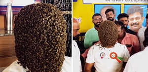 Binlerce arı yüzünü kapladı 5 saat boyunca kıpırdamadan bekledi