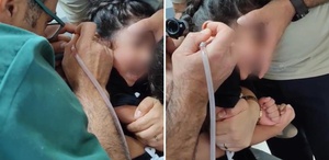Bir aylık ağrının nedeni dehşete düşürdü 5 yaşındaki çocuğun kulağından canlı çıkarıldı