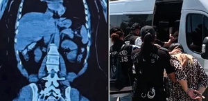 Midelerinde 1,5 kilo uyuşturucu çıkan 2 kadın tutuklandı