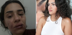 Eski sevgili, uzaklaştırma kararını hiçe sayıp dehşet saçtı Ebru hemşirenin sesini duyun