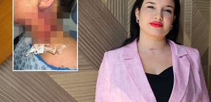 Güzelleşmek isterken hayatından oluyordu