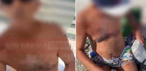 Sahilde genç kızın gizlice fotoğrafını çekti Fark edilince bakın ne yaptı
