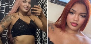 21 yaşındaki anne yanmış halde bulundu Ölmeden önce söyledikleri ürpertti