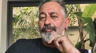 Cem Yılmaz, baston kullanmaya başladı