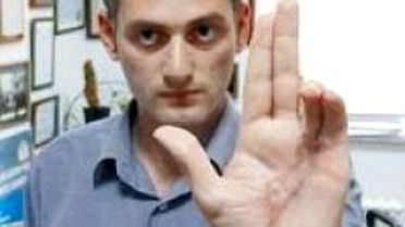 34 Bin Volt Elektrik Çarptı, Sağ Kurtuldu
