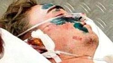 'Mucize Çocuk'tan Bir Mucize Daha