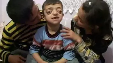Küçük Yusuf'un Dramı Yürek Burkuyor