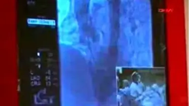 Çanakkale - Canlı Yayınla Kalp Ameliyatı Eğitimi