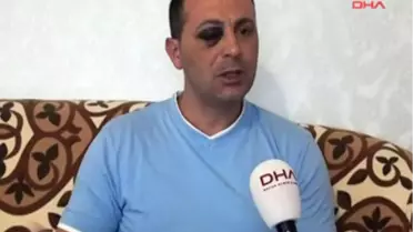 Alman Polisi Şiddette Sınır Tanımadı