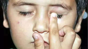 Ailenin 'Pitbul'lu Dehşet Gecesi