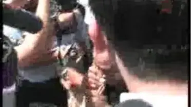 Adana Ekg Öğretmenin Krizi